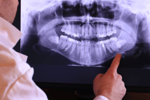 Best Emergency Treatment for Jaw Pain or Injury in Fort Lupton, CO